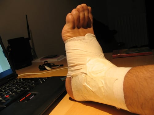 ankle_injuries_Exercises 305886698 9832bbd8f0 Ankle Injuries & Exercise with Jimmy Smith