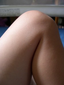 ACL Knee Injury1 224x300 Is Downhill Walking Good For You After Anterior Cruciate Surgery?