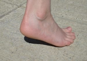 Plantar Fasciitis Exercises 300x213 What is Plantar Fasciitis?