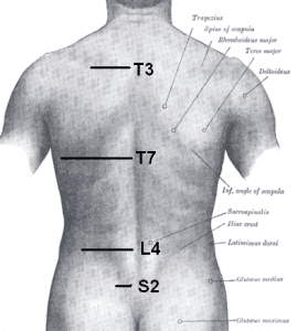 How Common are Spinal Fusions 269x300 How Common is Spinal Fusion Surgery?