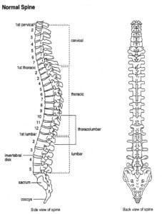 What Makes Up Spinal Fusion 227x300 How Common is Spinal Fusion Surgery?