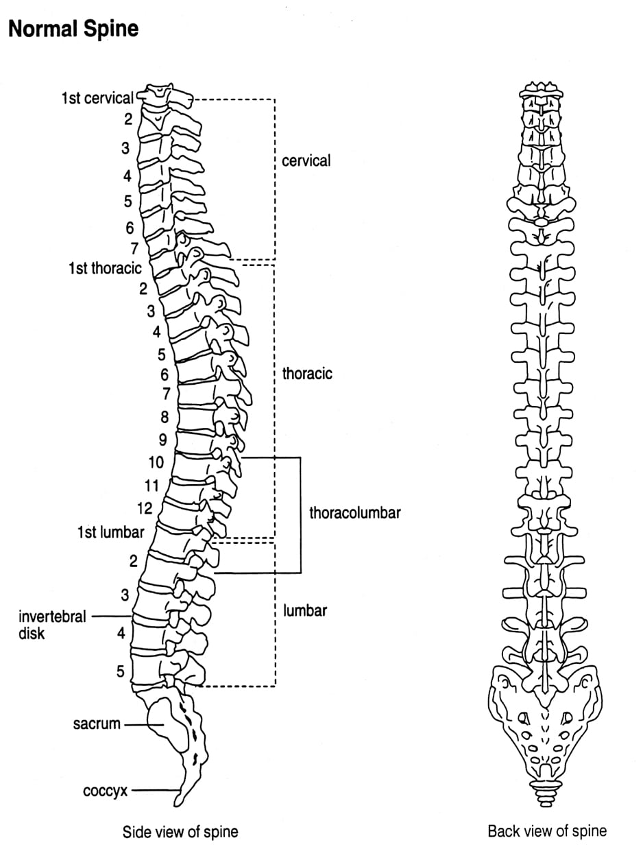 Fused Vertebrae