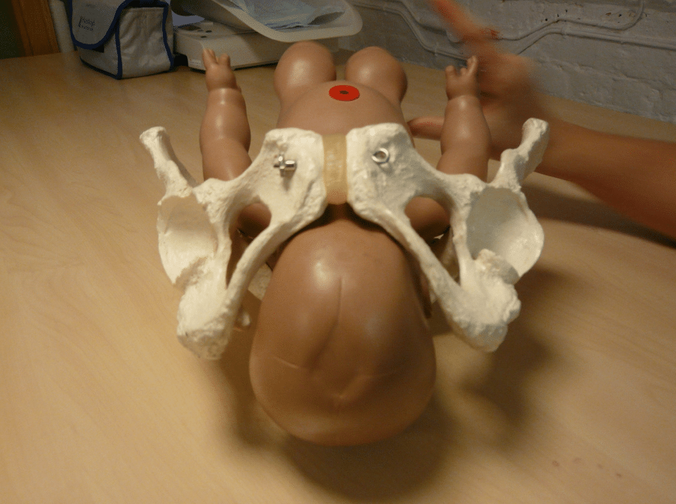 Female-Pelvis-Wider Female Pelvis Wider ACL Injuries in Female Athletes