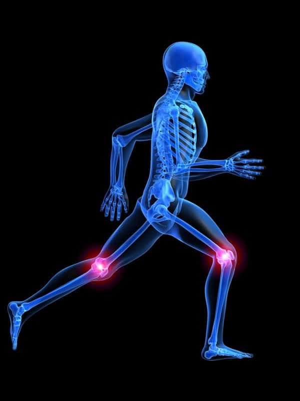 Patellofemoral Pain Syndrome