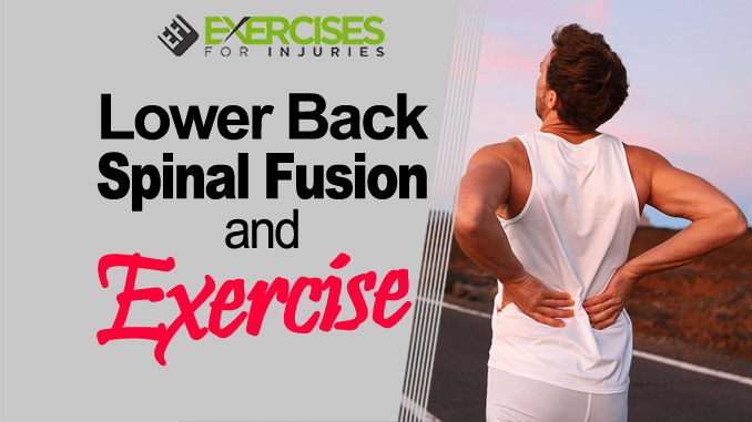 Lower Back Spinal Fusion and Exercise (Webinar