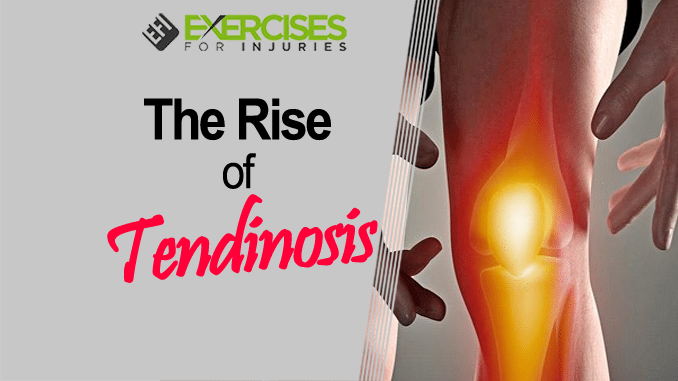 The Rise of Tendinosis copy