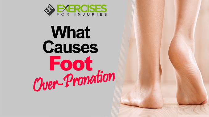 What Causes Foot Over-Pronation copy