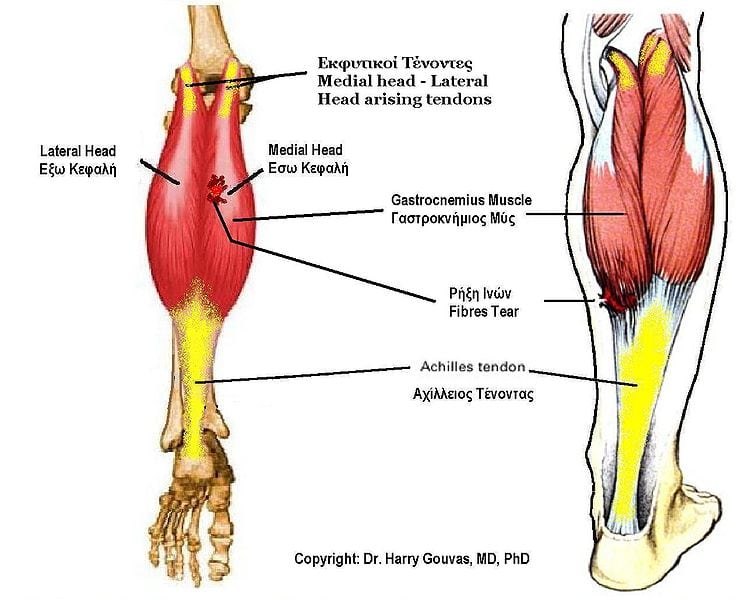 Achilles Tendonitis and Exercises  Exercises For Injuries