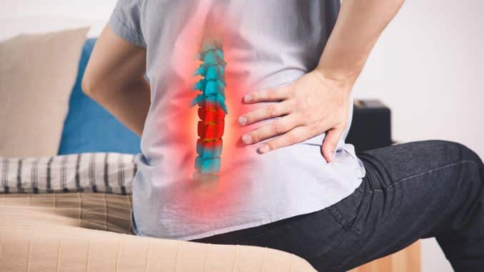 Disc Herniations