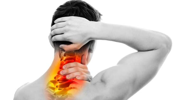 cervical fusion