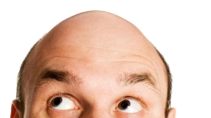 bald-head-looking-up - causes of hair loss