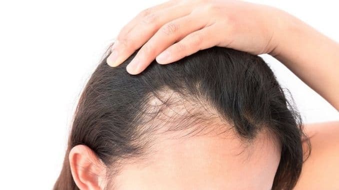 woman scalp - causes of hair loss