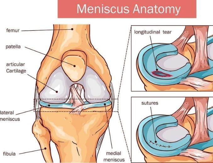 Meniscus Anatomy