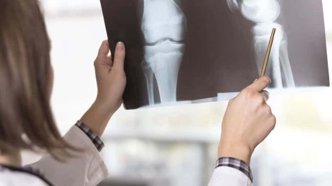 knee- joint -xray - Anatomy of the Knee