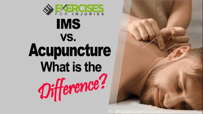 IMS vs. Acupuncture — What Is the Difference 1