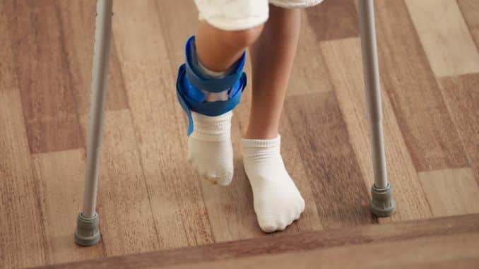 Preparing for a Date on Crutches- Low-Cost Fun Date Nights for Couples