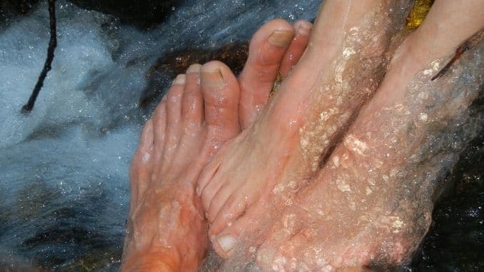 feet-water-cold Reduce Symptoms of Raynaud's Disease