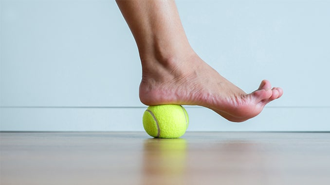 Plantar Fasciitis