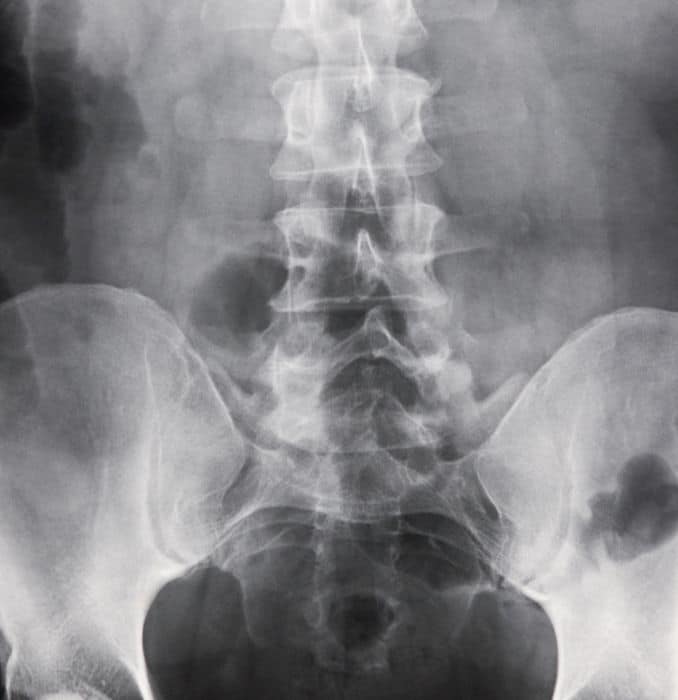 coccyx standing