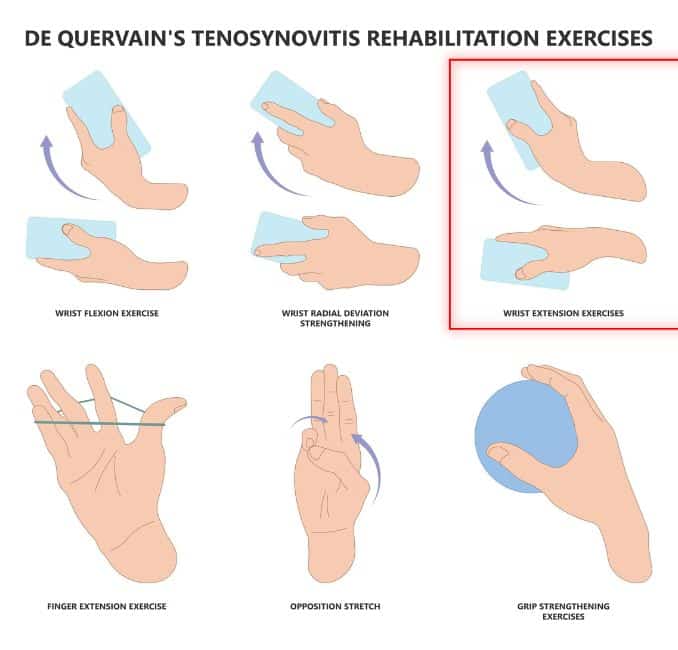 Wrist Extension- gamer's thumb