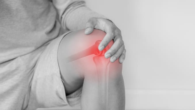 Arthritis
