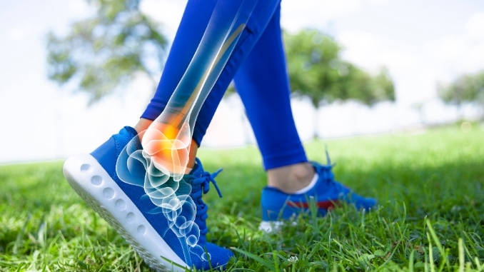 Anatomy of Weak Ankles