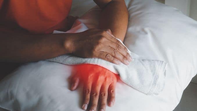 ice therapy