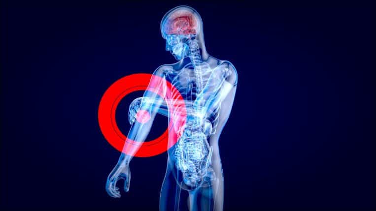 anatomy-concept-elbow-pain