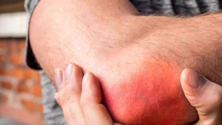 man-feeling-pain-his-elbow
