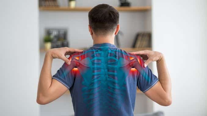 scapular-periarthritis-shoulder