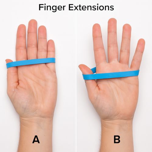 Rubber Band Finger Extensions